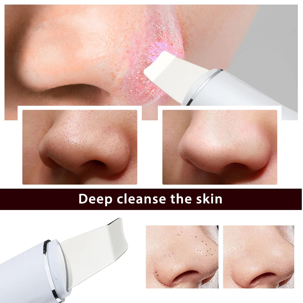 Ultrasonic Skin Scrubber Peeling Blackhead Remover Machine EMS Deep Face Cleaning Ultrasonic Ion Acne Pore Cleaner Facial Shovel